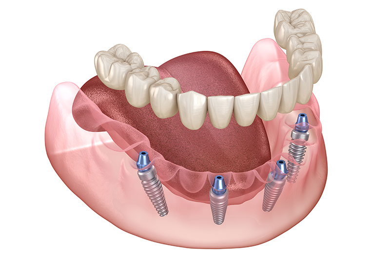 Dentist in Yonkers