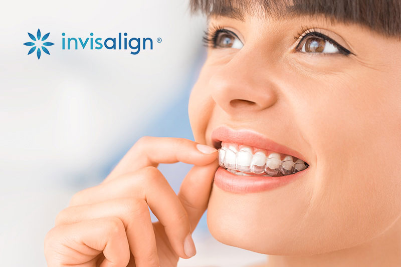Invisalign in Yonkers