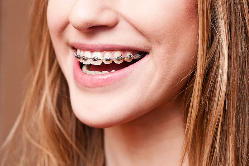 Orthodontics in Yonkers