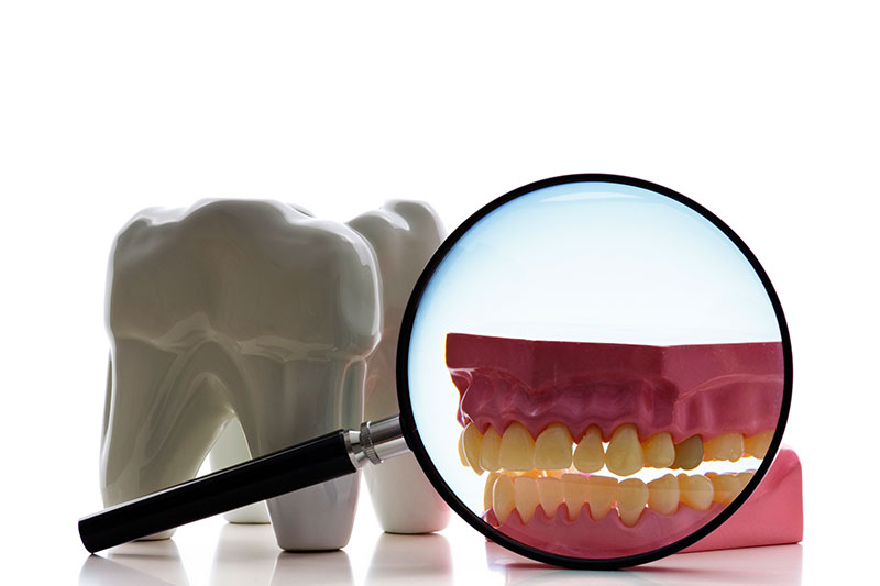 Root Canal in Yonkers